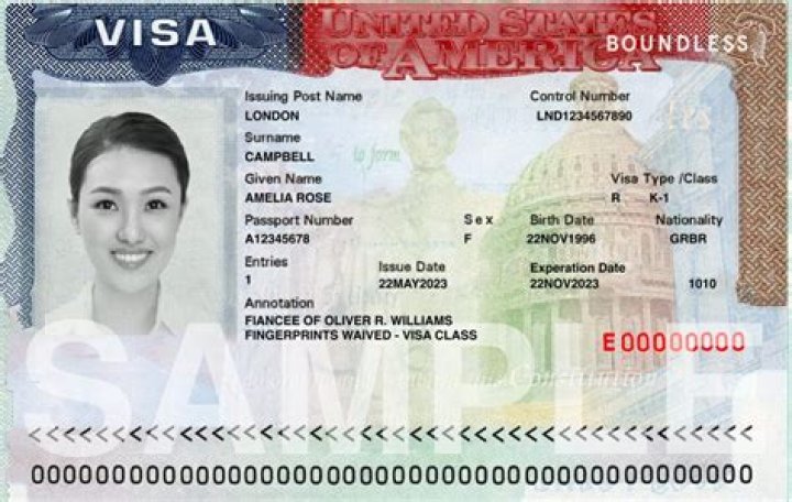 Can a L-1 visa holder become a US resident?