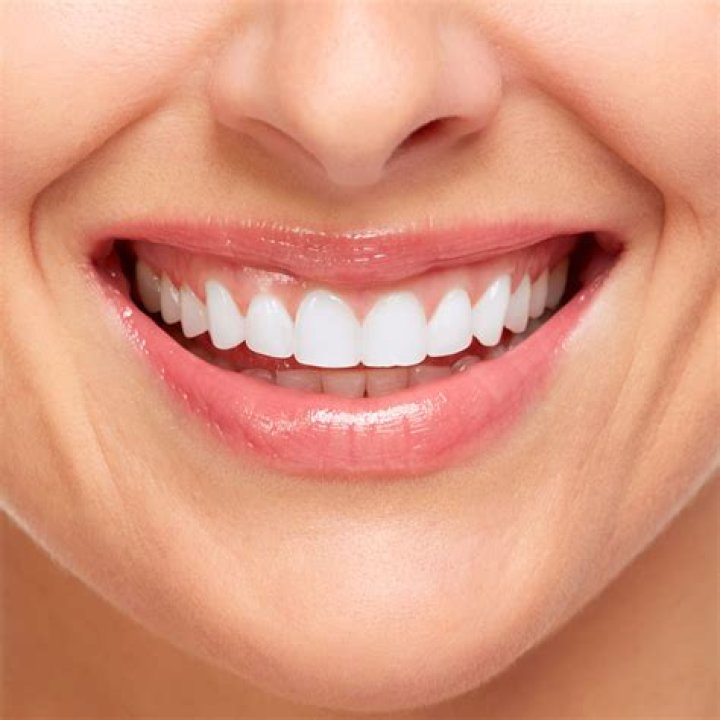 Can you deduct cosmetic dental work?