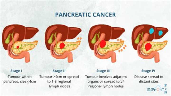 How long can a cancer patient live in hospice?