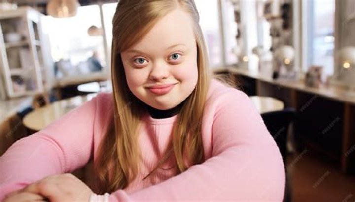 How mentally disabled are people with Down syndrome?