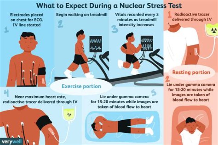 How often should you have a nuclear stress test done?