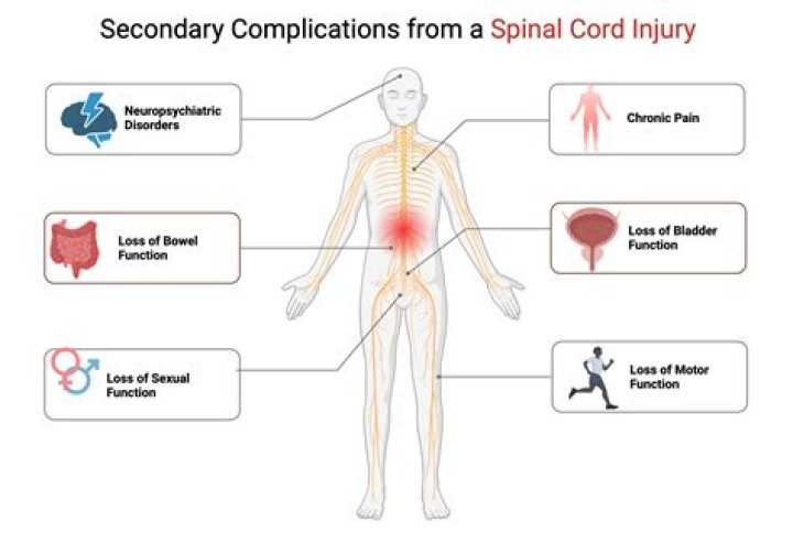 Is a spinal cord injury fatal?