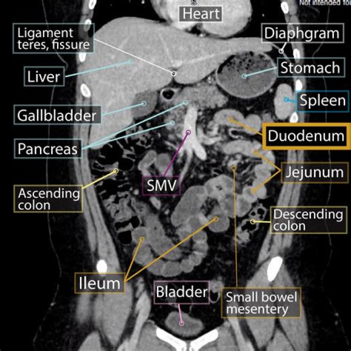 What is a CT-3 form?