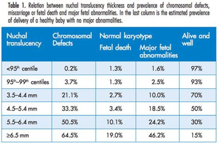 What is considered high risk for Down syndrome?