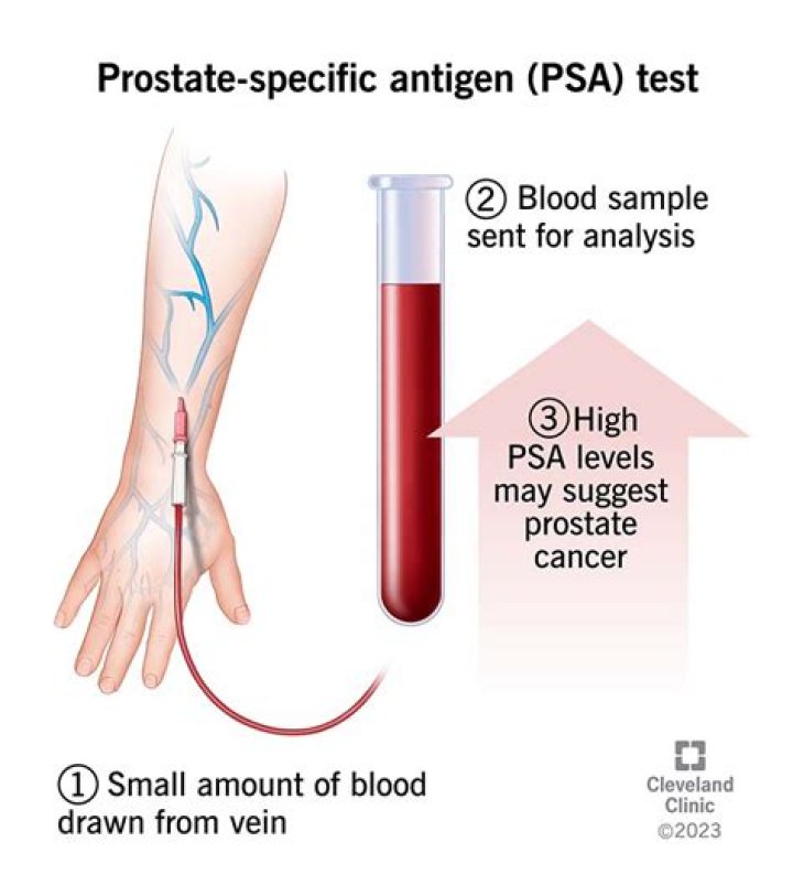 What percentage of PSA tests are false?
