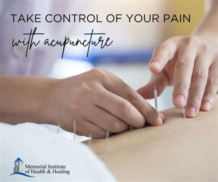 Who can practice acupuncture in Illinois?